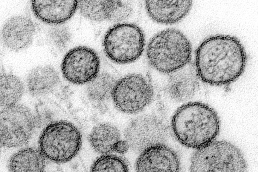 WHO bestätigt Mensch-zu-Mensch-Übertragung von Hantavirus nach tödlichem Ausbruch auf Kreuzfahrtschiff
